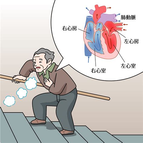 呼吸困難心理作用|呼吸困難